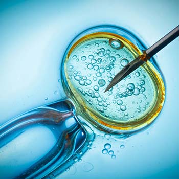 Infertilidad – femenina, masculina – fertilización asistida - invitro